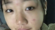 脸上有痘的小姐姐是谁,痘痘肌小姐姐的美丽蜕变记